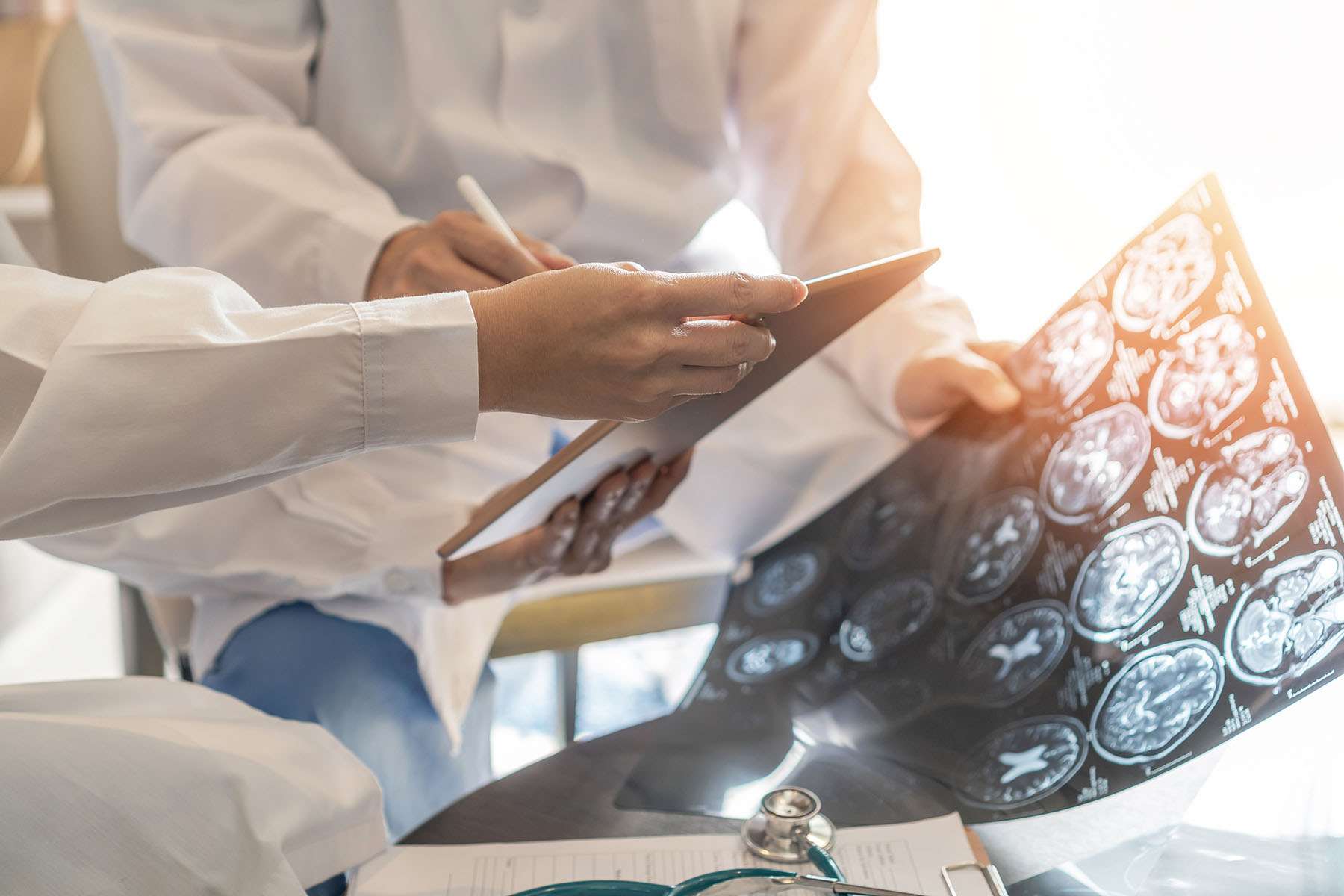 Doctors discussing the results of an X-Ray